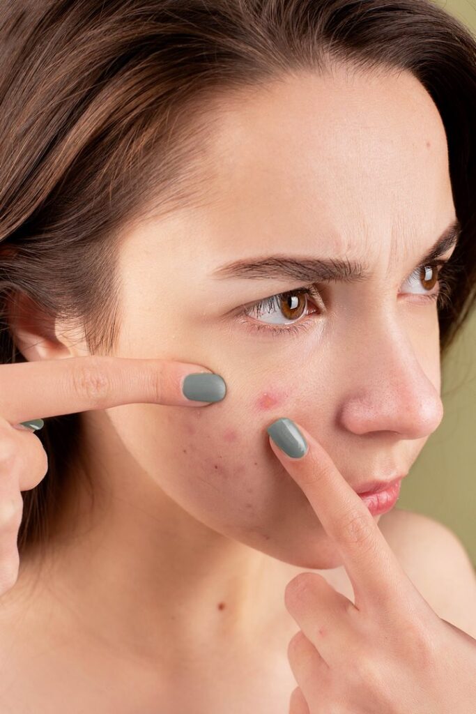 Avoid These 10 Mistakes To Keep Your Skin Clear