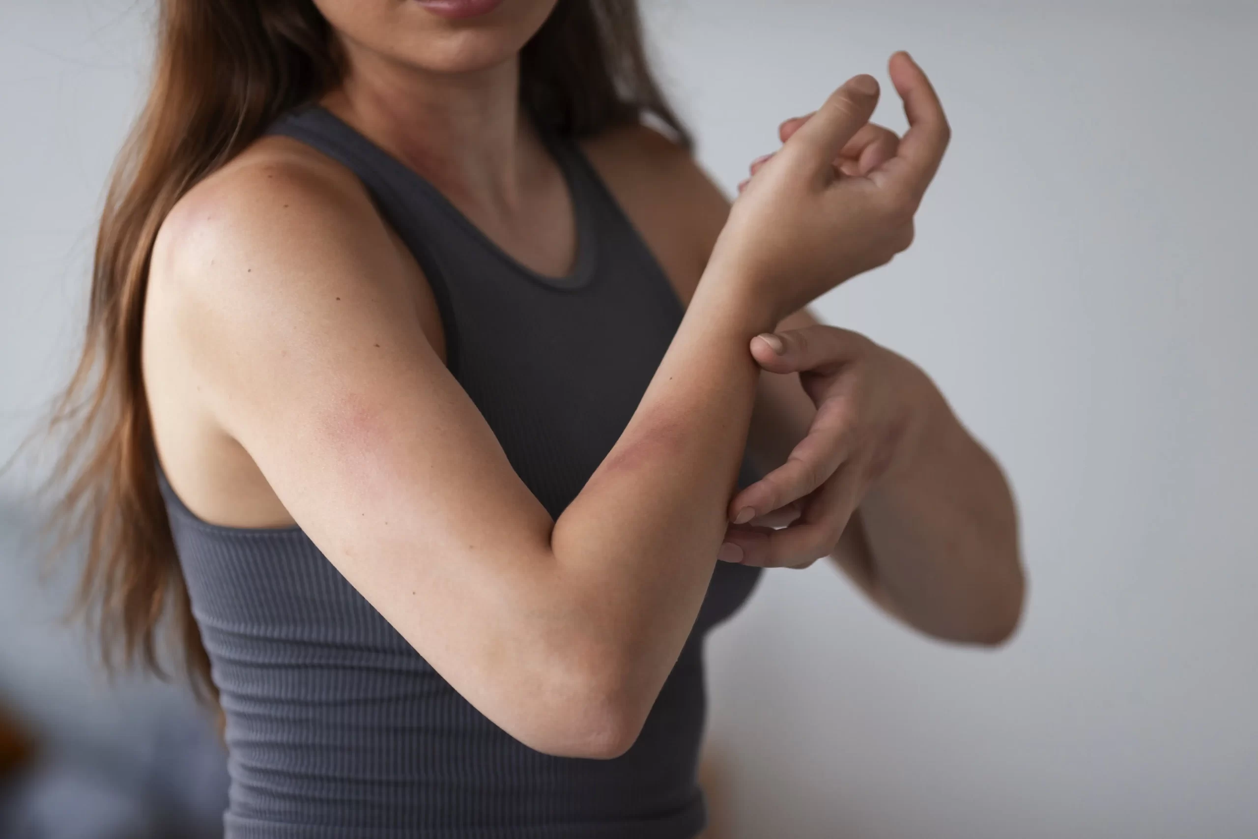 what-to-do-when-your-child-has-a-rash-cwwchc-health-blog