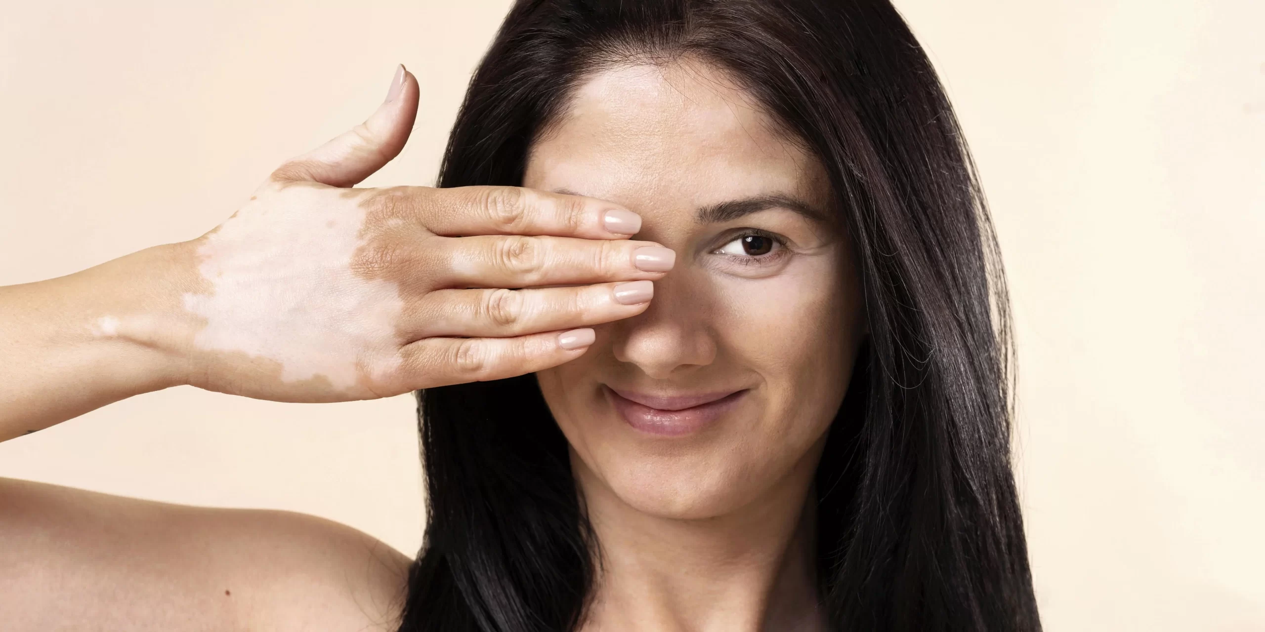 WHITE PATCHES ON SKIN CAUSES AND HOME REMEDIES: Unveiling the Truth 