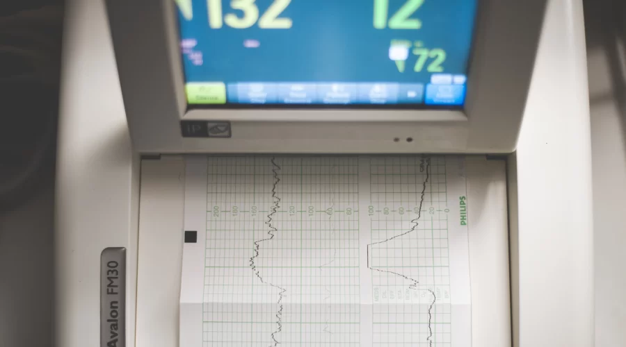 ECG: Everything You Need To Know About Electrocardiogram