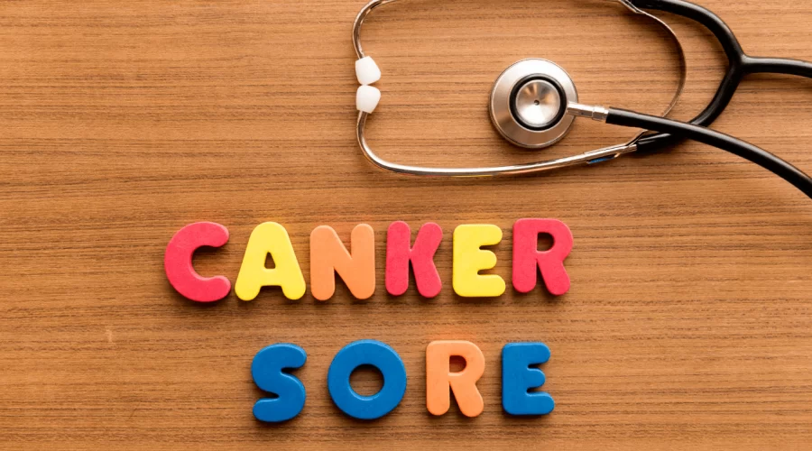 Canker sores - Causes, Symptoms, and Treatments