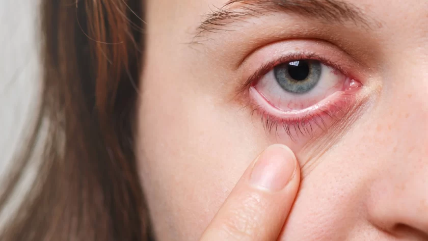 Red eyes: causes, advice against eye irritation