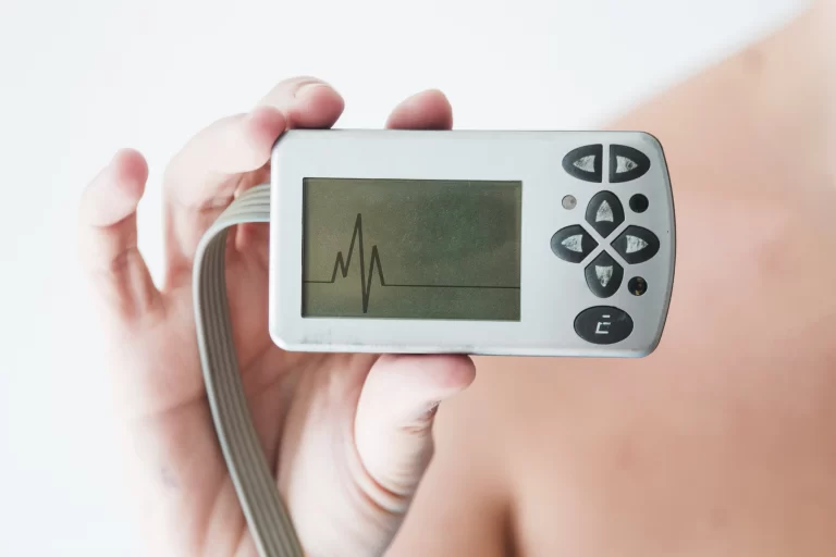 Holter ECG: what is it for, what is its role?