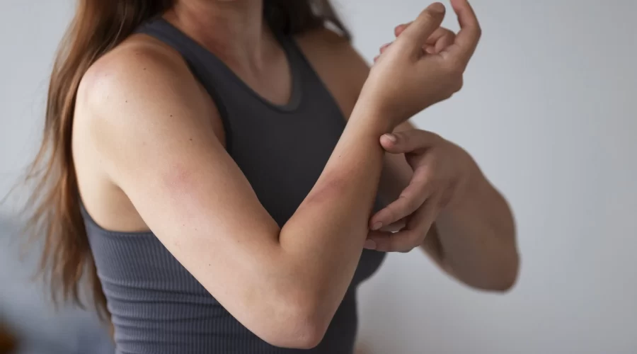 Skin rash: causes, symptoms, and treatments