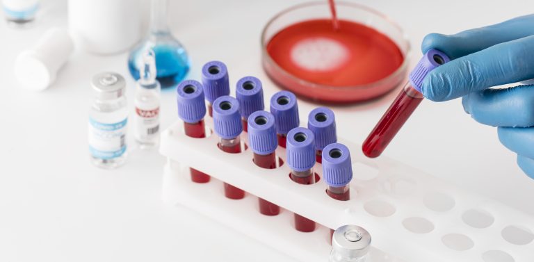 What is blood gas analysis?